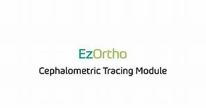 EzOrtho – EzDent-I Workflow