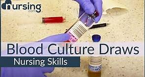 Blood Culture Draws- Top Priorities (Nursing Skills)