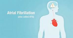 What is Atrial Fibrillation?