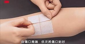 3M™ 免縫膠帶黏貼應用技巧─無滲液傷口
