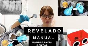 Revelado manual de radiografías dentales