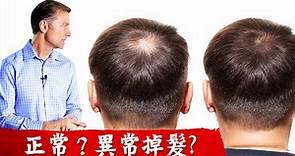 (頭髮1)正常掉頭髮或異常,4原因,補充營養素? 柏格醫生 Dr Berg
