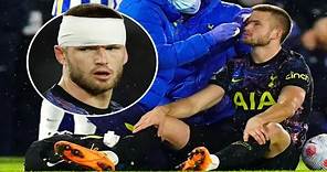 Eric Dier head INJURY Vs Brighton