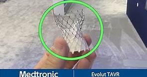 Medtronic Evolut Transcatheter Aortic Valve Replacement (TAVR) at TCT 2023