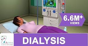Procedure of DIALYSIS