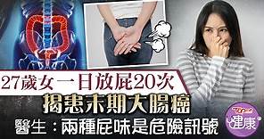 【癌症殺手】27歲女日放屁20次揭患末期大腸癌　醫生：兩種屁味是危險訊號 - 香港經濟日報 - TOPick - 健康 - 健康資訊