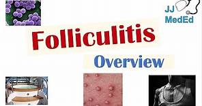 Folliculitis | Causes (Bacterial, Fungal, Viral), Risk Factors, Symptoms, Diagnosis, Treatment
