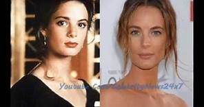 Gabrielle Anwar Plastic Surgery Before and After HD