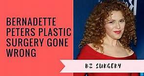 Bernadette Peters Plastic Surgery Gone Wrong
