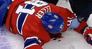 NHL: Painful Injuries