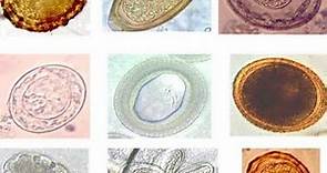 Stool staining, Microscopic examination, Diagnosis of parasites