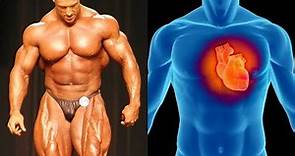 10 Bodybuilders who Died of Heart Attacks before 50