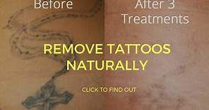 How To Remove Tattoos Naturally