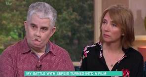 My Battle With Sepsis Has Been Turned Into A Film | This Morning