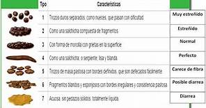 🛑💩SALUD - ESCALA DE HECES DE BRISTOL💩🛑💥🚺🚹🚽🧻🧻🧻💩💩💩💩💩💩💩💩💩💩💩💩💩💩💩💩💩💩💩💩💩💩💩💩💩💩💩💩💩💩💩💩💩💩💩💩💩💩💩💩💩💩💩💩💩💩💩💩💩💩💩💩💩💩💩