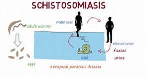 Schistosomiasis (Bilharzia)– an overview