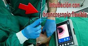 Intubación con broncoscopio flexible: la técnica explicada con el paso a paso