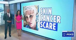 Christie Brinkley skin cancer scare