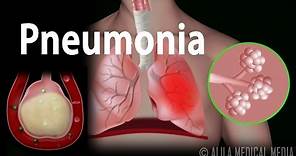 Pneumonia, Animation