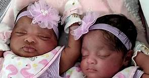Woman gives birth to twins while in a coma due to coronavirus