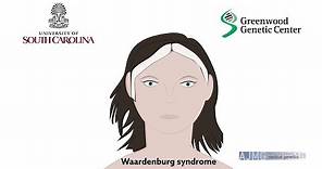 Biallelic deletions of the Waardenburg II syndrome gene, SOX10, cause a recognizable arthrogryposis
