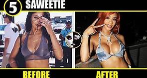 Saweetie Plastic Surgery Before and After ( Botched Boob Job | Butt Implants ) - Plastic Surgery TV