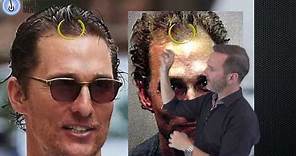 Matthew McConaughey Hair Transplant Results or A Good Wig?