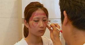 Behind the plastic surgery boom in South Korea