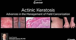 Actinic Keratosis: Advances in the Management of Field Cancerization