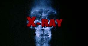 Hospital Massacre/X-Ray (1981) | HORROR/SLASHER | FULL MOVIE