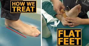 How We Treat Flat Feet | Collapsed Arches | Physical Therapy