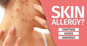 What is Skin Allergy? Symptoms, Causes, Diagnosis and Triggers