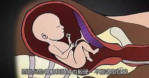 婦產科醫生解釋13至24週墮胎流程