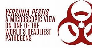 Yersinia pestis: A microscopic view on one of the world's deadliest pathogens