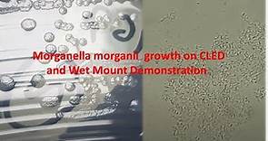 Morganella morganii Colony Morphology and Microscopy