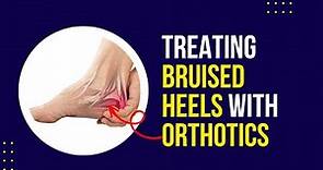 How Do We treat Bruised Heels with Orthotics