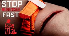 Stop Bleeding ⎮ Save Lives