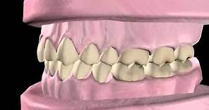 What is Orthodontics?