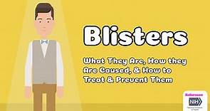 Blisters - What They Are, How they Are Caused, & How to Treat & Prevent Them
