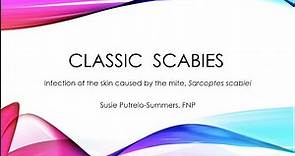 Classic Scabies: A brief overview of diagnosis and treatment