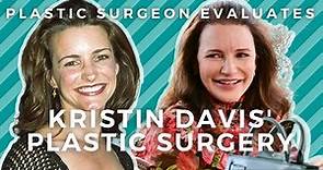 Kristin Davis Plastic Surgery: Did Charlotte from SATC have work done?