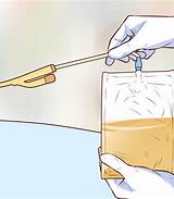 pemasangan kateter urin
