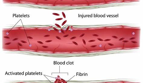 Blood Clotting - Anatomy Ch. 10: Blood