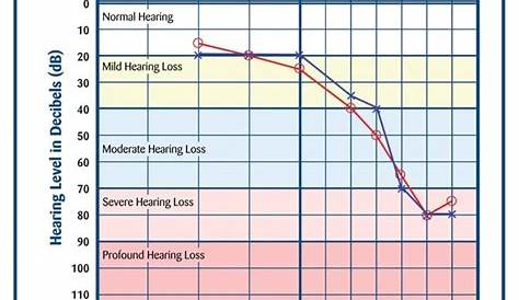 hearing test chart explained
