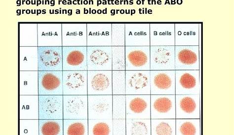 nobel prize blood typing game worksheet answers