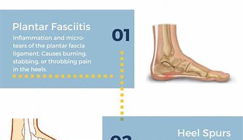 foot pain diagnosis chart