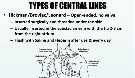 PPT - Central Lines: Patient Safety Considerations PowerPoint