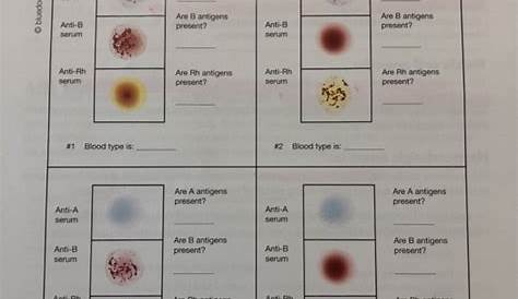 blood typing questions and answers