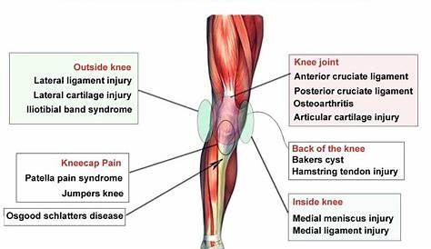 Sharp Knee Pain Diagnosis Chart