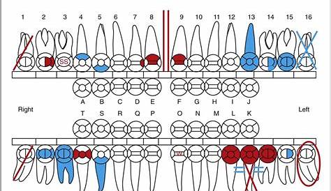 Easy Way To Learn Dental Charting - Best Picture Of Chart Anyimage.Org